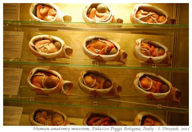 Babies in mothers womb, Palazzo Poggi, Bologna, Italy - S. Deepak, 2011