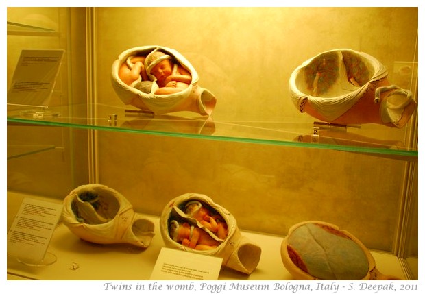 Twins in the womb models, Poggi museum - S. Deepak, 2011