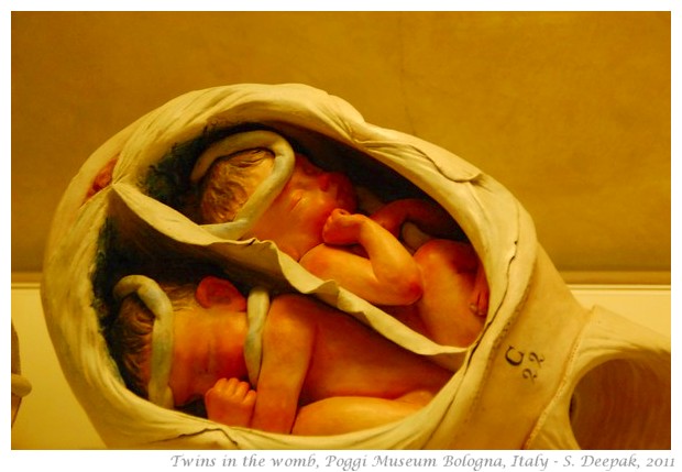 Twins in the womb models, Poggi museum - S. Deepak, 2011
