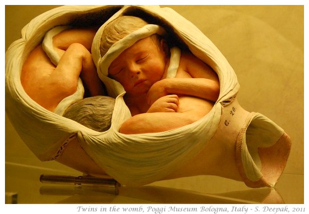 Twins in the womb models, Poggi museum - S. Deepak, 2011